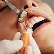 The number of NHS dentists in Fife has gone down since the pandemic.